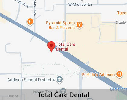 Map image for Root Canal Treatment in Addison, IL